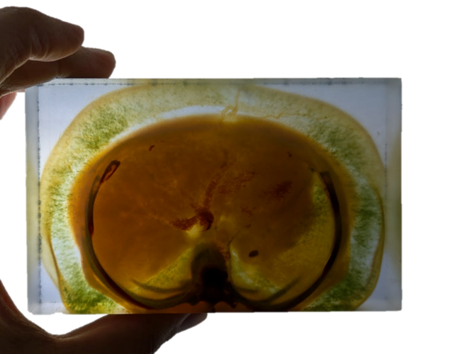 Example 3 – Inkjet 3D Printed Medical Scan