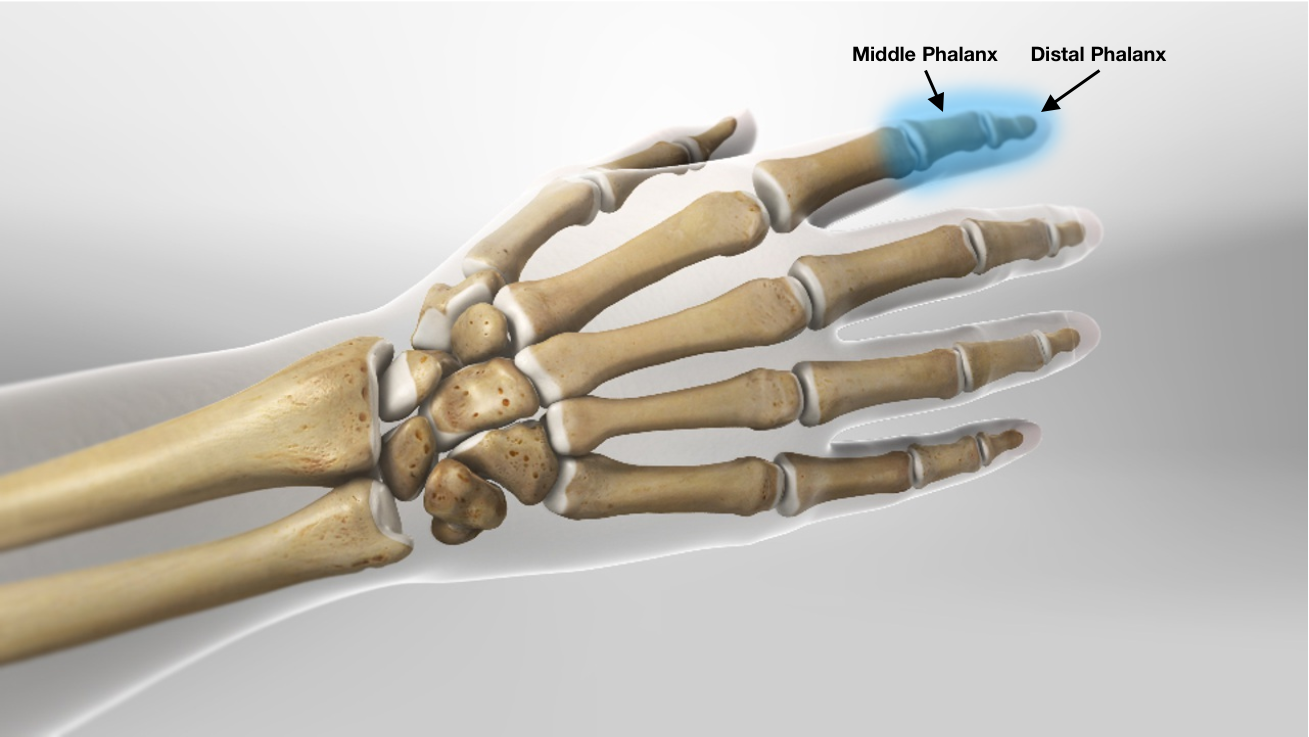 mk6_hand_bone_anatomy_diagram.png